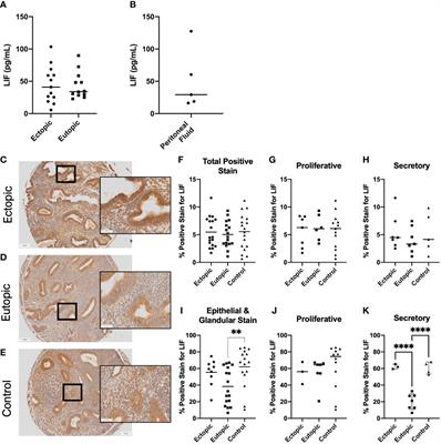 The dysregulation of leukemia inhibitory factor and its implications for endometriosis pathophysiology
